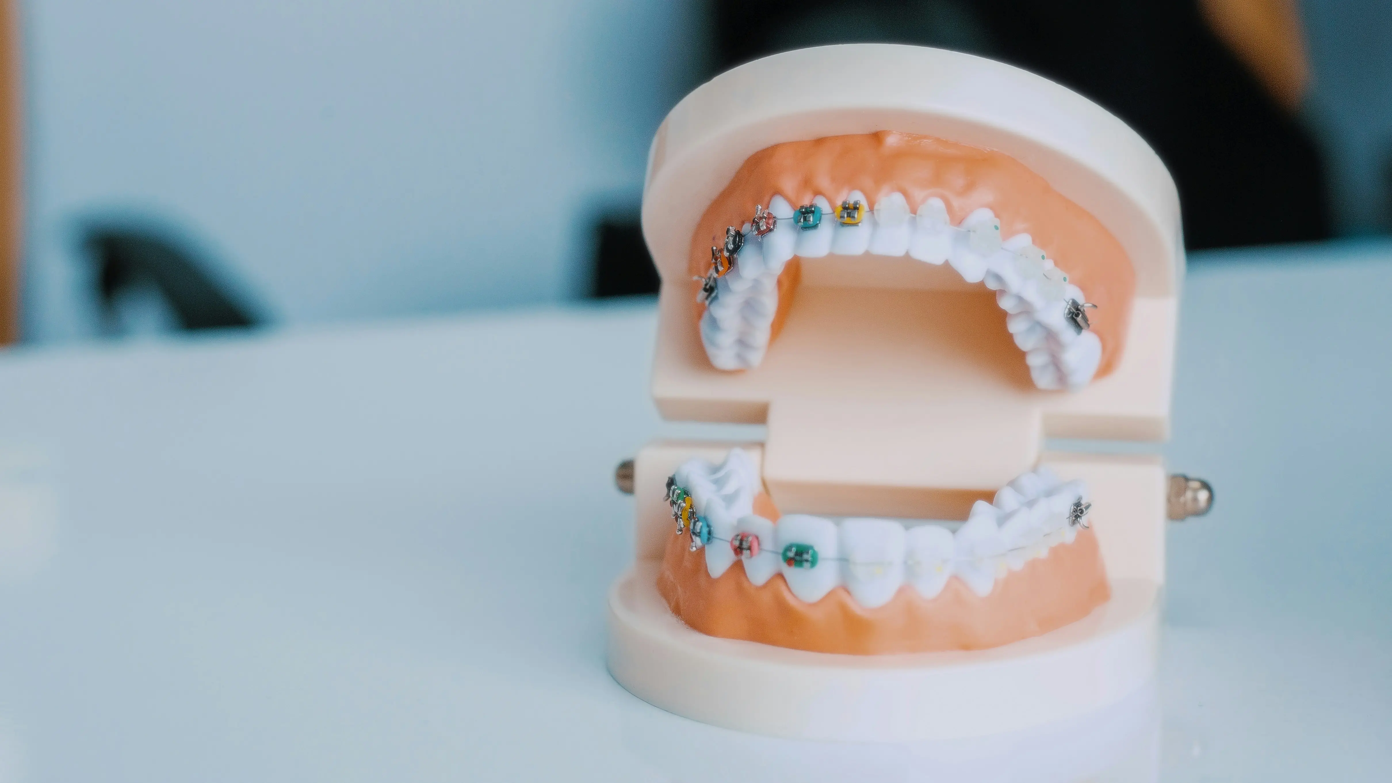 Need Dental Implants? Discover Cost, Options & Same-Day Solutions in the U.S.